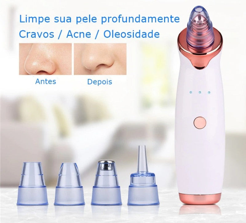 Removedor de Cravos e Espinhas à vácuo - Clear Skin